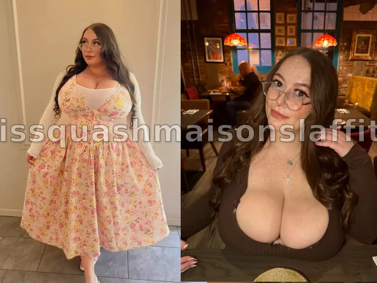 Une Écossaise souffrant d'une maladie rare du sein dénonce le mépris des médecins pendant plus de dix ans